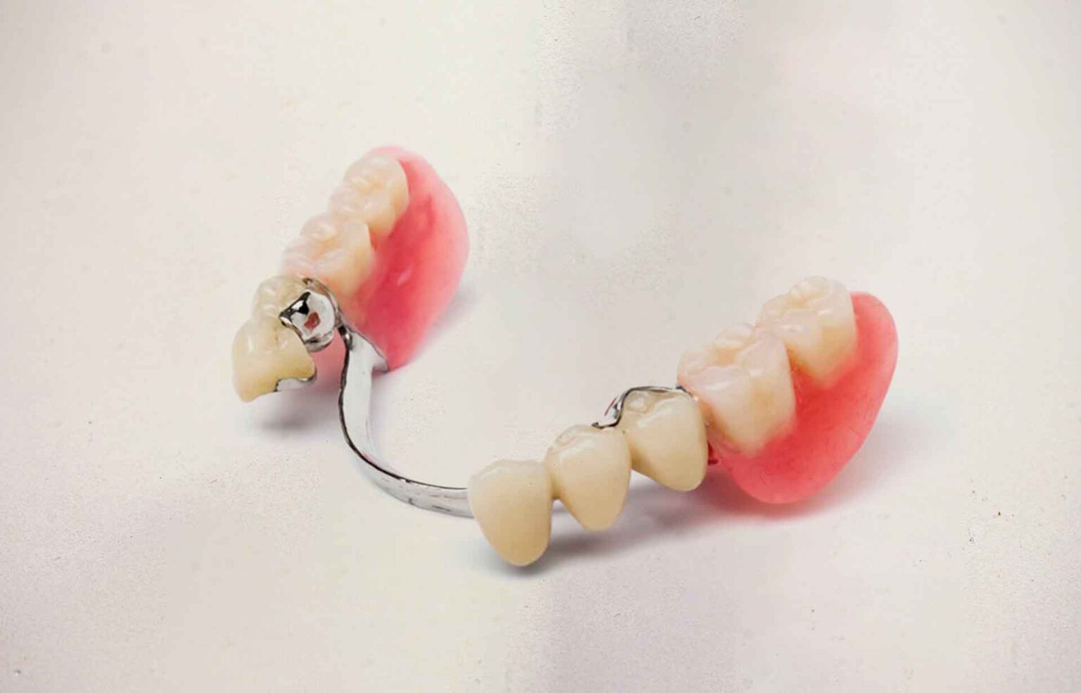 Prótesis removible base metálica parcial - 3Dentalab